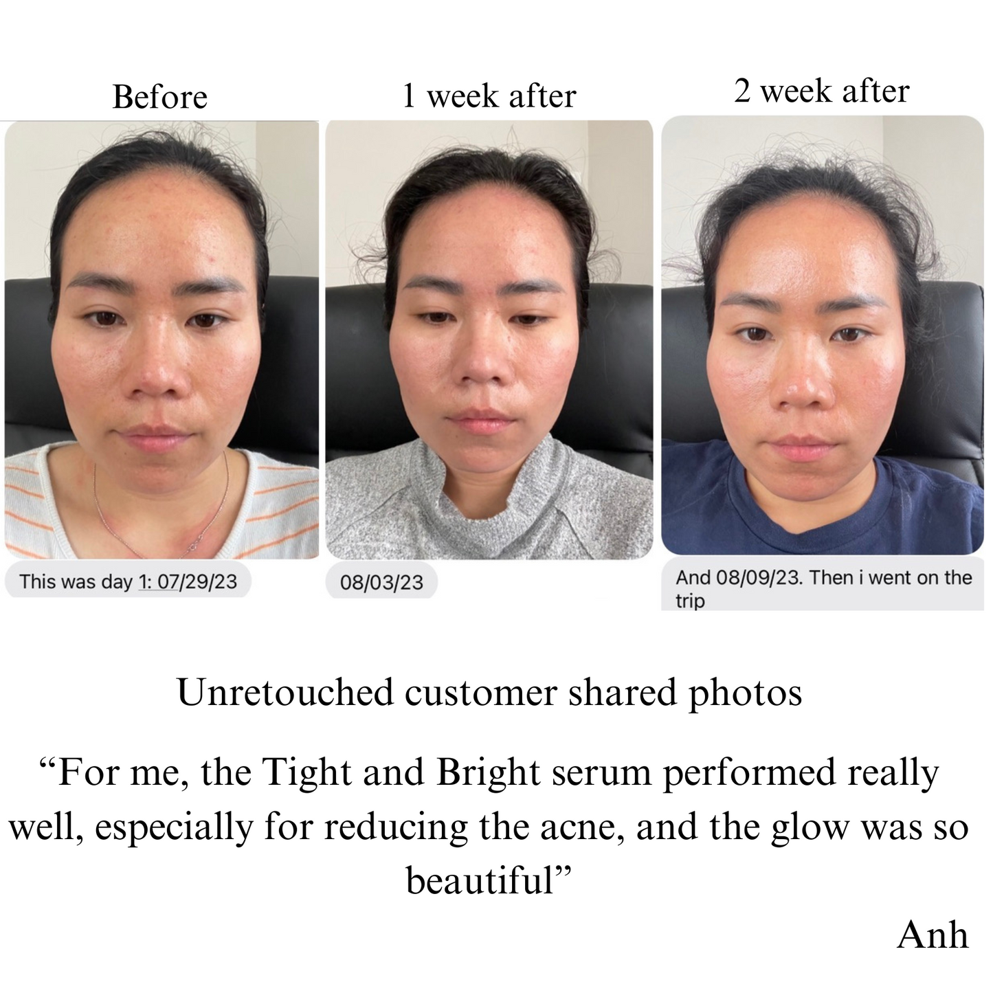 Hyperpigmentation TRIO, Brightening and Collagen Boosting Age-Defying Bundle 20% off
