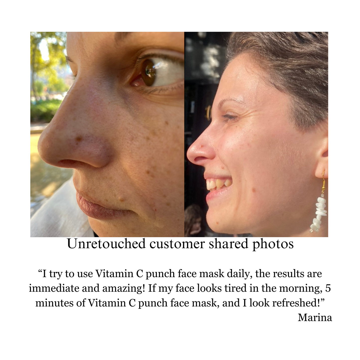 Hyperpigmentation TRIO, Brightening and Collagen Boosting Age-Defying Bundle 20% off