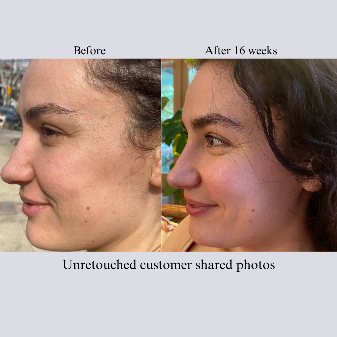 Hyperpigmentation TRIO, Brightening and Collagen Boosting Age-Defying Bundle 20% off