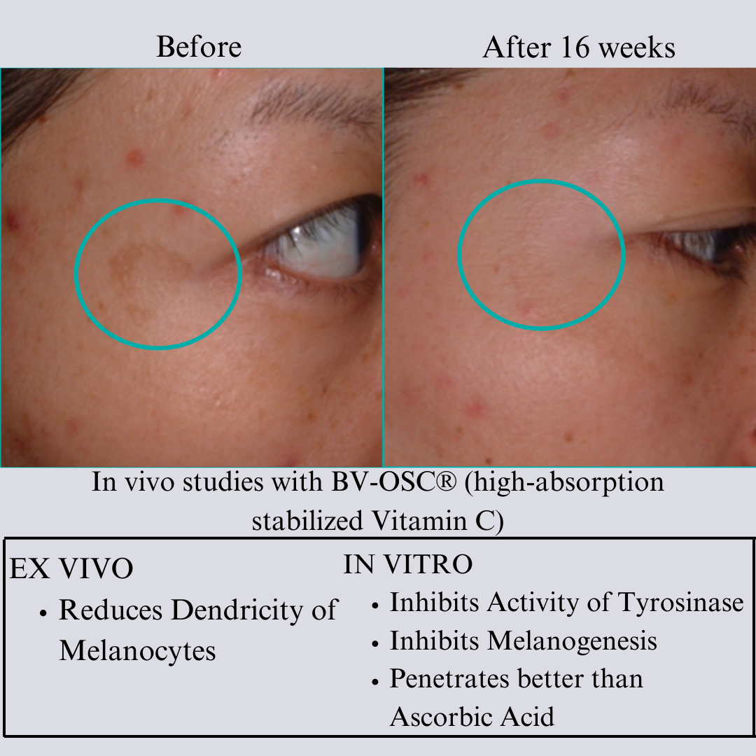 Hyperpigmentation TRIO, Brightening and Collagen Boosting Age-Defying Bundle 20% off