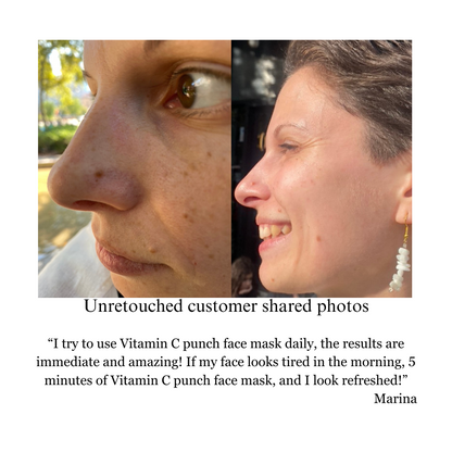 Hyperpigmentation TRIO, Brightening and Collagen Boosting Age-Defying Bundle 20% off