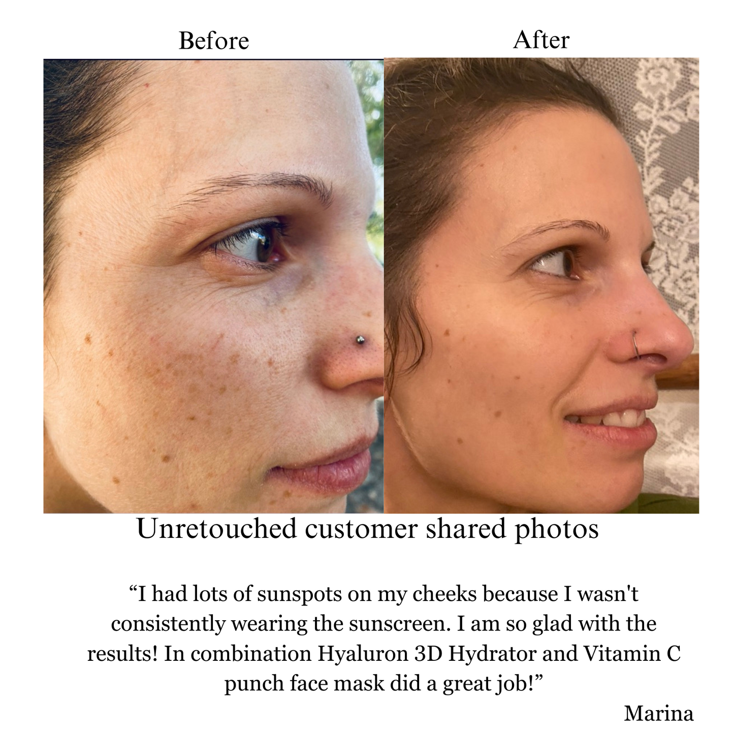 Hyaluron 3D Hydrator Multi Lamellar Emulsion The Advanced Response Face and Neck Cream-Serum